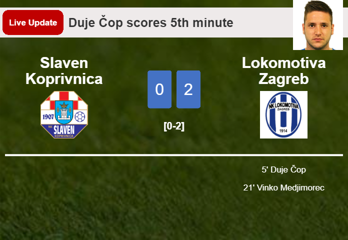 LIVE UPDATES. Lokomotiva Zagreb extends the lead over Slaven Koprivnica with a goal from Vinko Medjimorec in the 21st minute and the result is 2-0