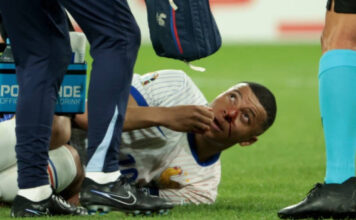 Kylian Mbappé Hospitalized After Suffering Broken Nose In France’s Euro 2024 Opener
